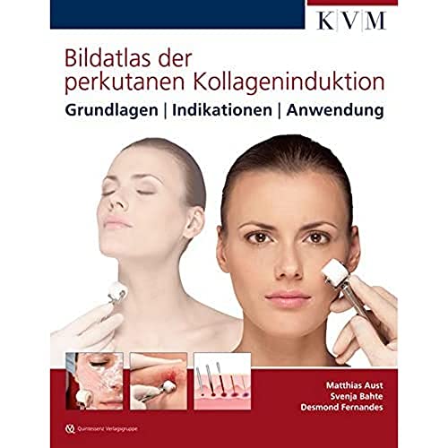 Bildatlas der perkutanen Kollageninduktion: Grundlagen | Indikationen | Anwendung von KVM-Der Medizinverlag